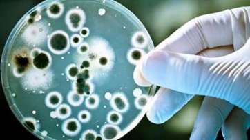 Medidas recomendadas ante infecciones por Streptococcus